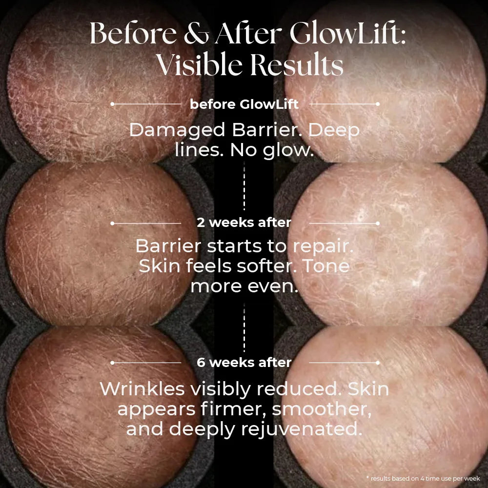 Glowlift™ | 5-In-One Sculptor & Radiance Booster