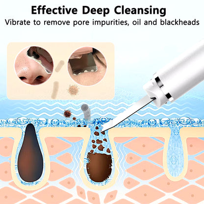 Ultrasonic Skin Scrubber Facial Deep Cleansing Blackhead Remove Ultrasonic Cleansing Cavitation Peeling Shovel Skin Scrubber